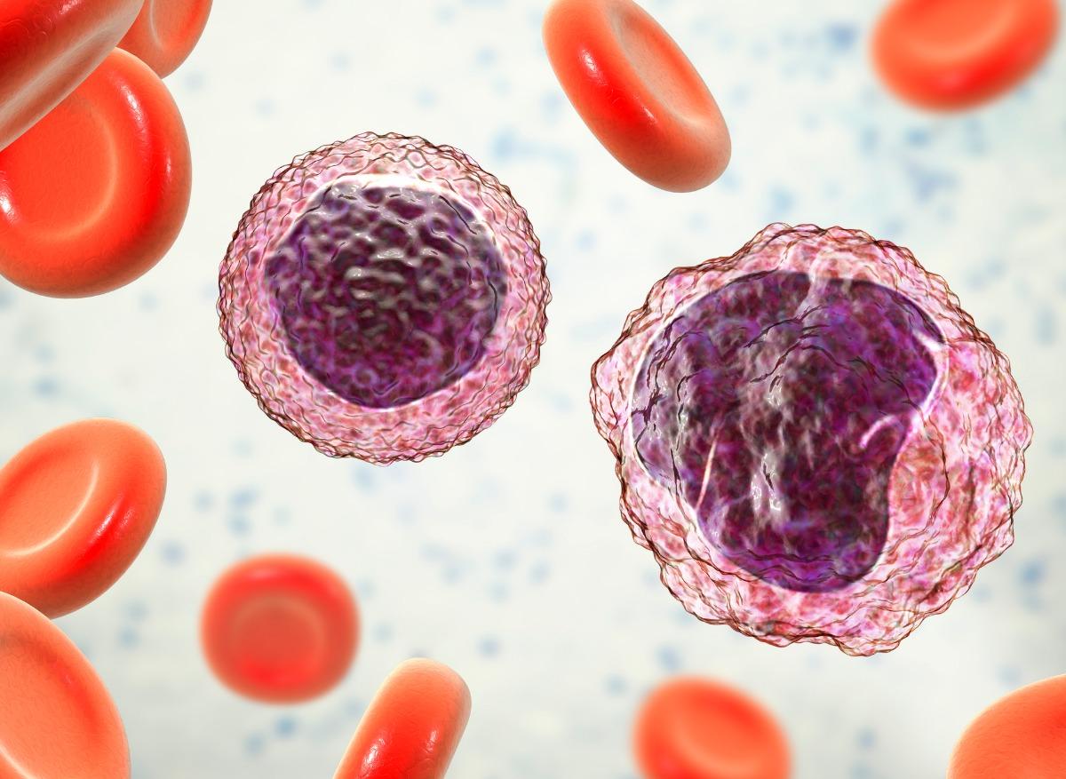 Cancer du sang : un gène identifié comme oncogène dans le lymphome B