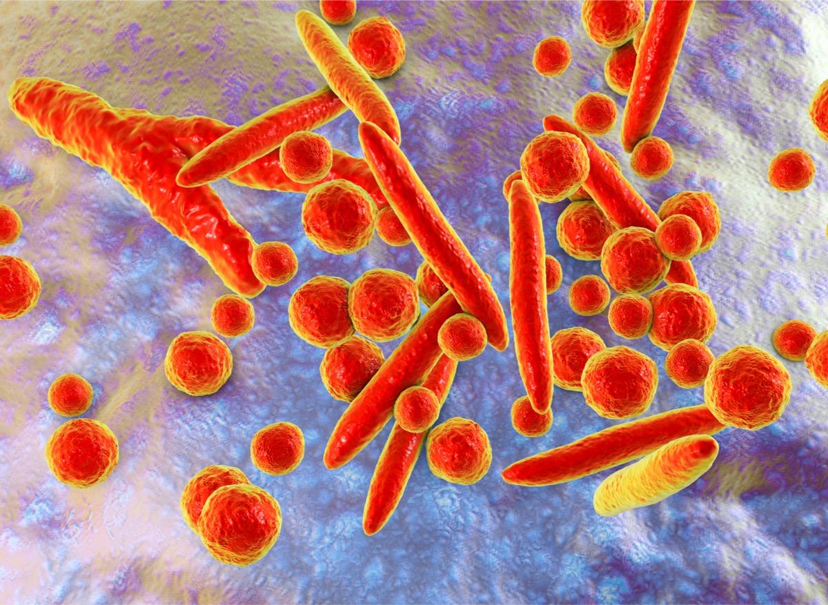 IST : une superbactérie résistante aux antibiotiques inquiète les scientifiques