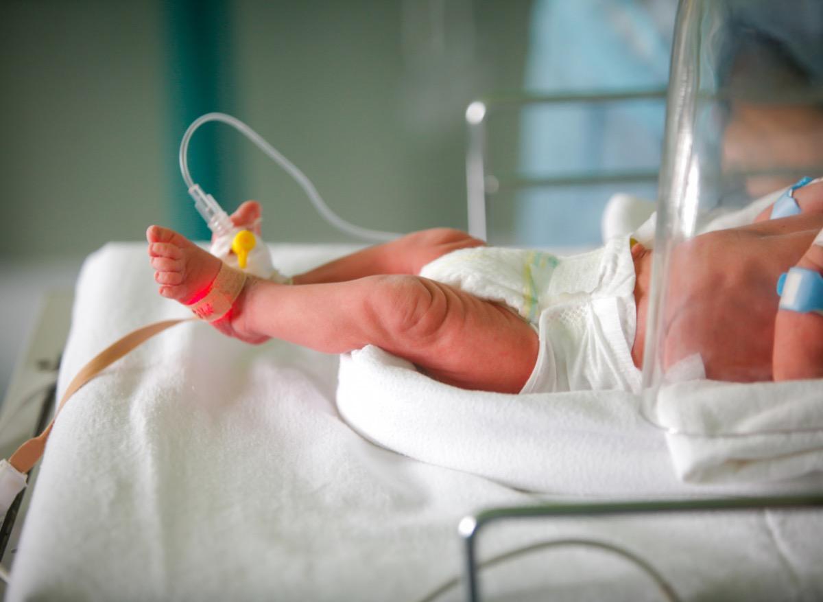 Canada : un bébé naît avec les intestins hors de son corps 