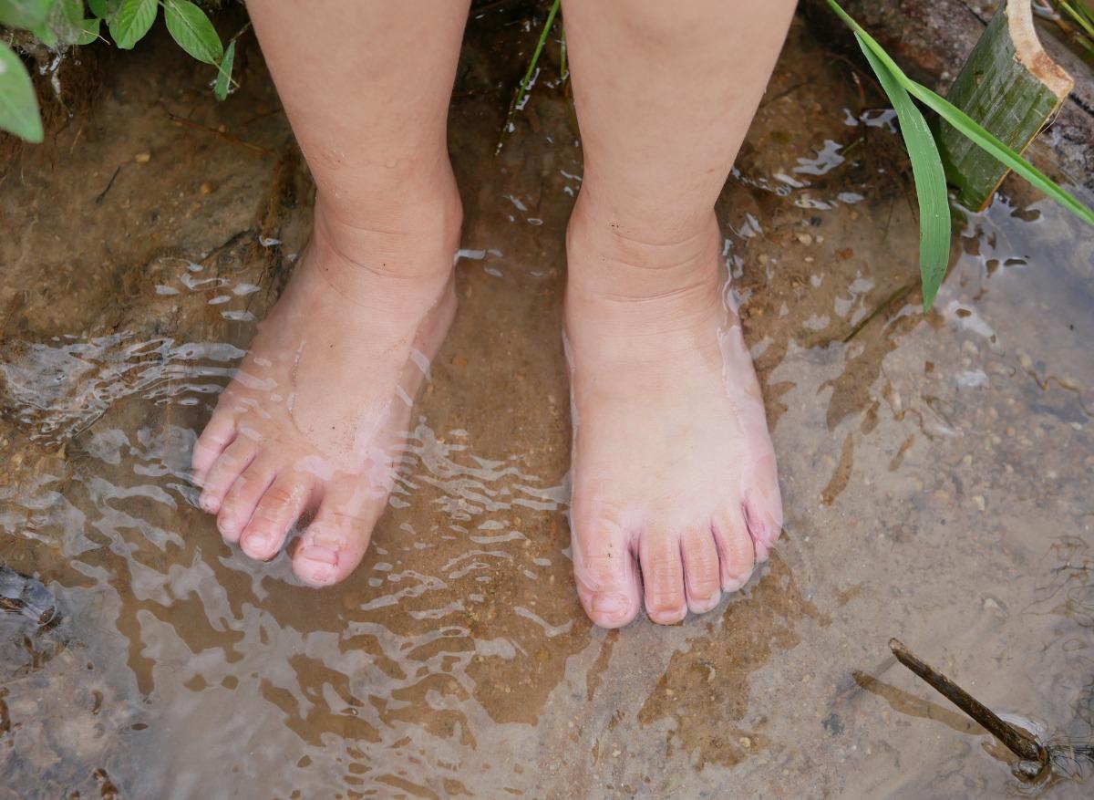 Une fillette revient des tropiques avec cette horrible infection des pieds