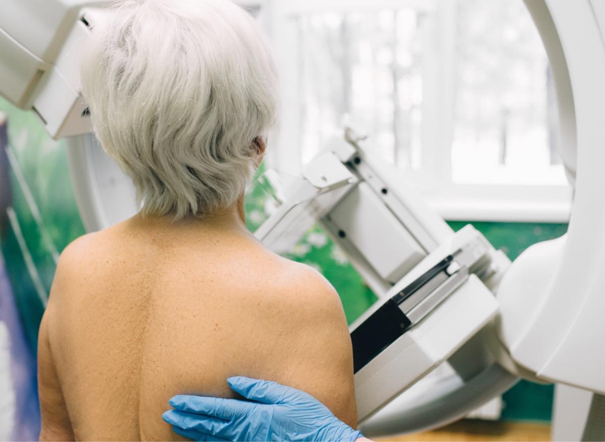 L'inquiétant recul des mammographies à cause de la pandémie 