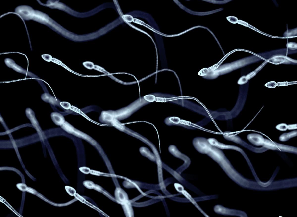 Fertilité : doit-on vraiment craindre une baisse de la qualité du sperme ?