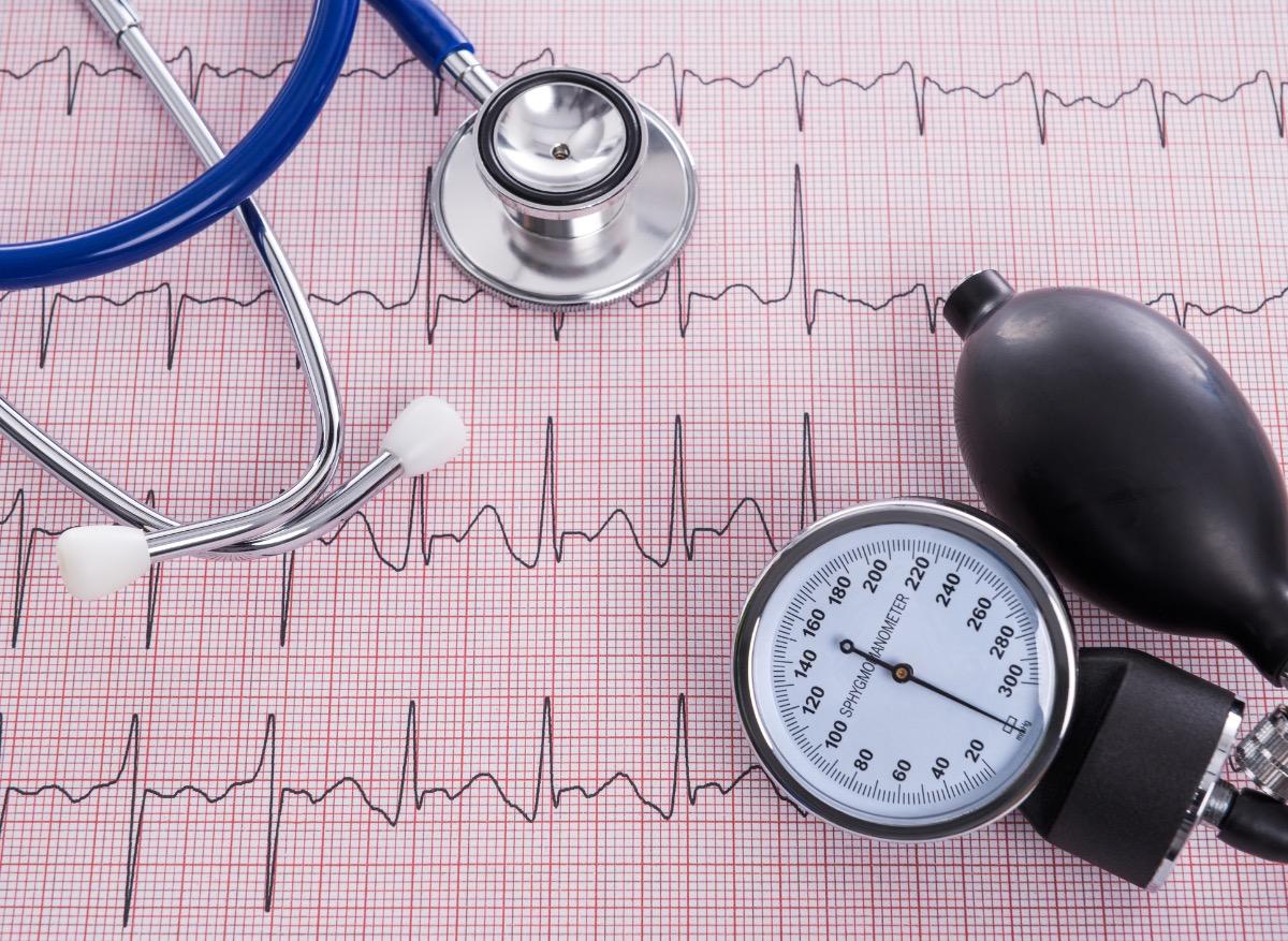 Trouble du rythme cardiaque : comment le prédire