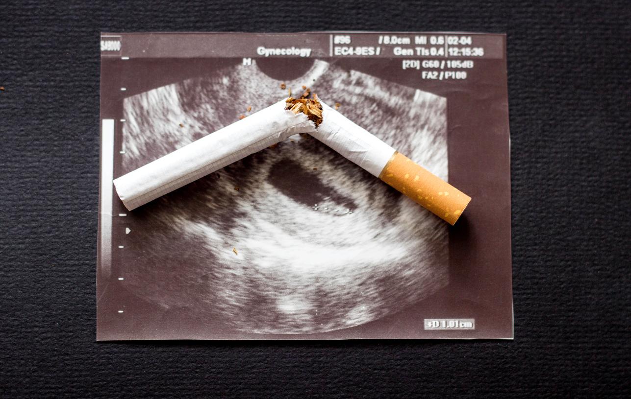 Le placenta conserverait la mémoire de l’exposition au tabac avant la grossesse