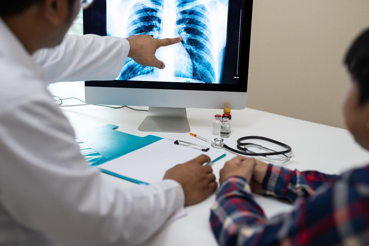 Cancer du poumon : les promesses de l'intelligence artificielle dans le dépistage