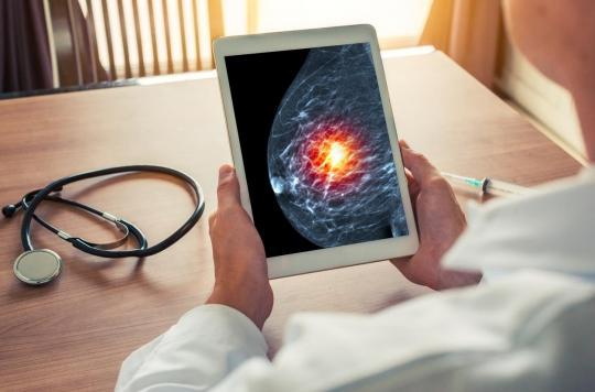 Cancer du sein : l'IA pour améliorer le diagnostic 