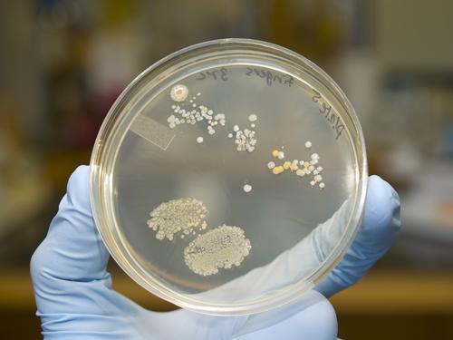 Italie :  découverte d'une super-bactérie résistante à tous les antibiotiques 