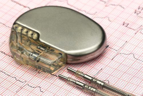 Piratage : des milliers de pacemakers doivent être mis à jour