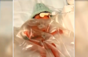 Un bébé de 400 grammes se bat pour survivre 