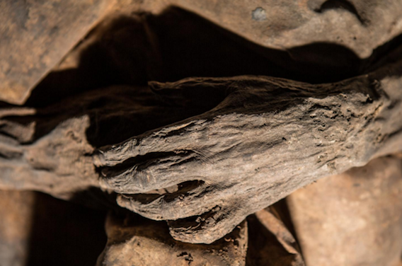 Variole : de l'ADN viral retrouvé dans une momie du 17e siècle