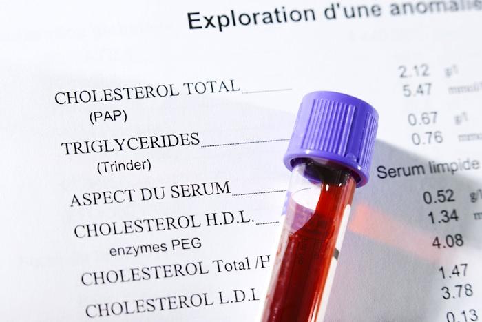 Cholestérol : les experts ajustent leurs recommandations 