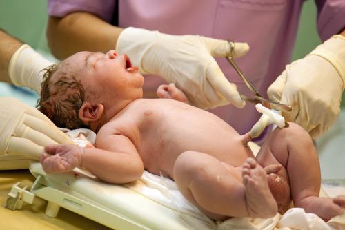 Nouveau-né : le clampage tardif du cordon prévient l'anémie 