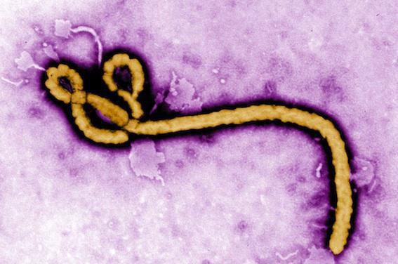 Ebola : des mutations font émerger des résistances aux traitements