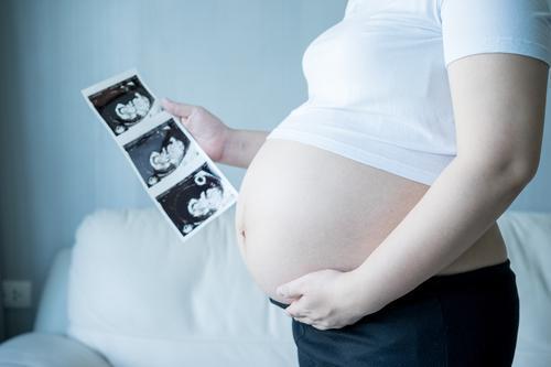 Trisomie 21 : le dépistage prénatal menacé