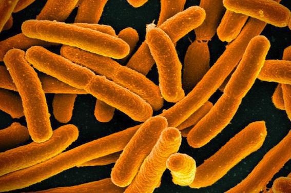 Etats-Unis : découverte d'une nouvelle bactérie multirésistante 