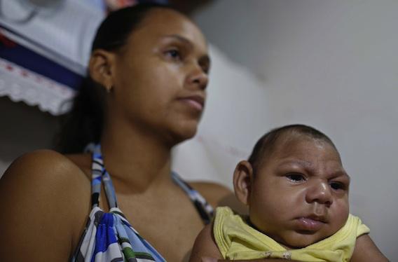 Zika : un premier lien établi avec la microcéphalie
