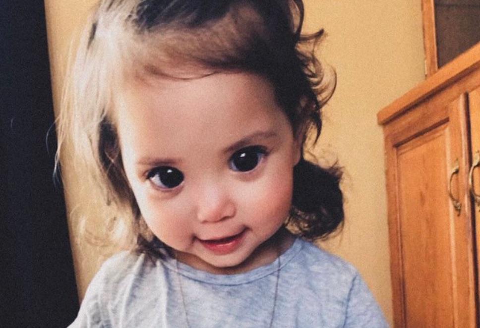 Cette belle petite fille doit ses grands yeux noirs à une maladie génétique rare