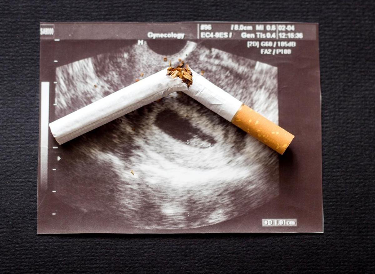 fausse couche cigarette électronique Exploring the Revolutionary Features of e Logic Cigarette for Modern Smokers