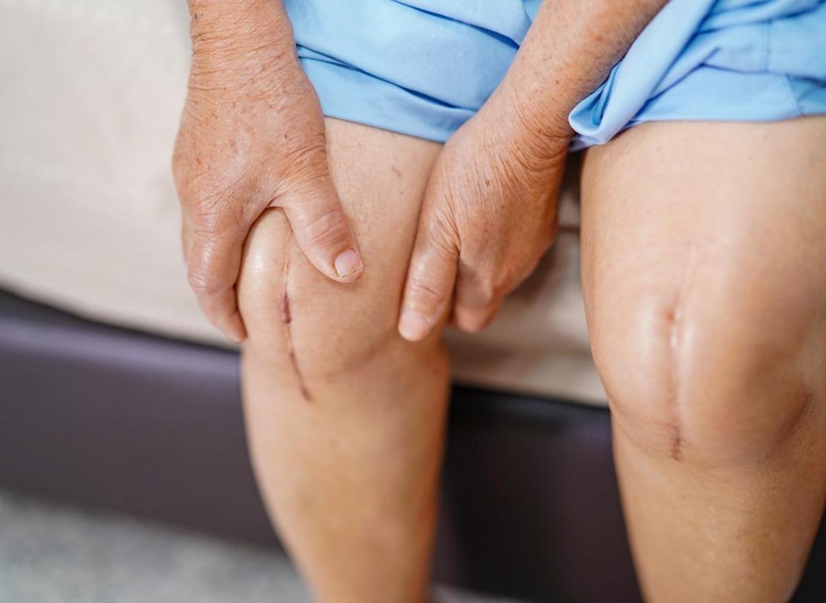 Arthrose du genou : trop de gens se font opérer tardivement