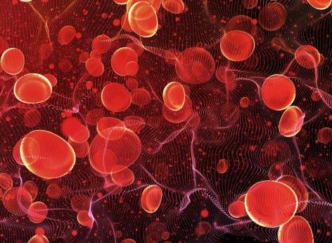 Hémophilie : quatre questions sur cette maladie encore peu connue 