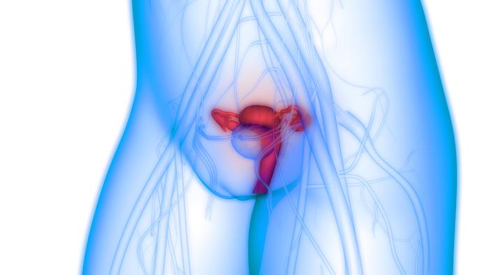 Cancer de l'ovaire BRCA-muté : intérêt d’un inhibiteur de PARP sur la survie sans progression
