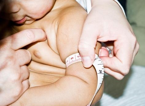 Grossesse : une carence en vitamine D augmente le risque d’obésité des garçons