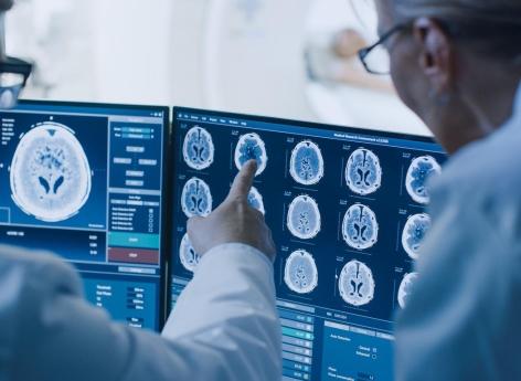 More patients have been saved thanks to this new AI