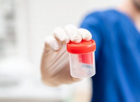 Alzheimer : un test urinaire pour détecter les formes précoces ? 
