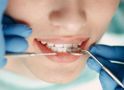 « Manquements aux règles d’hygiène » : les patients d’un cabinet dentaire appelés à se faire dépister