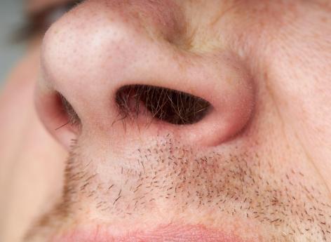 Doctors remove 150 insects from his nose