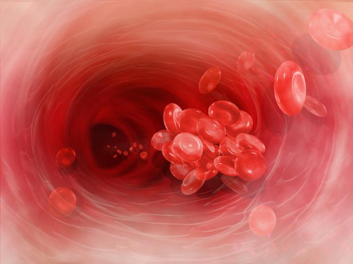 La thrombose artérielle augmente le risque de cancer 