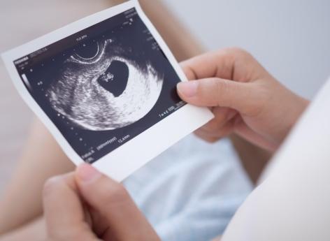 La pression dans l’utérus joue un rôle sur la formation du visage de votre bébé