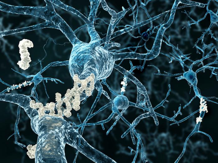 Alzheimer : le cerveau serait capable de compenser les lésions à un stade très précoce