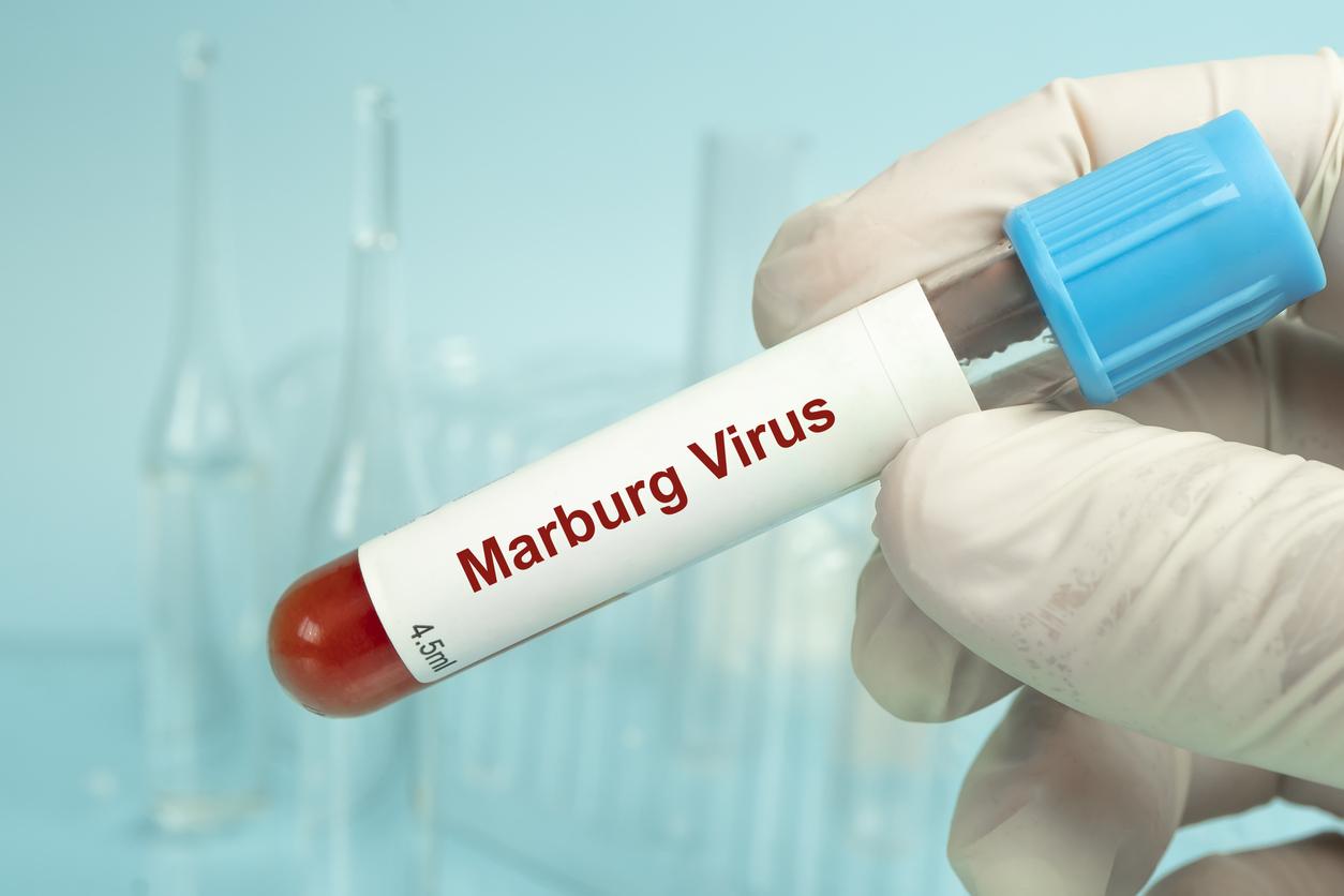 Épidémie en Éthiopie : quels sont les symptômes du virus Marburg ?