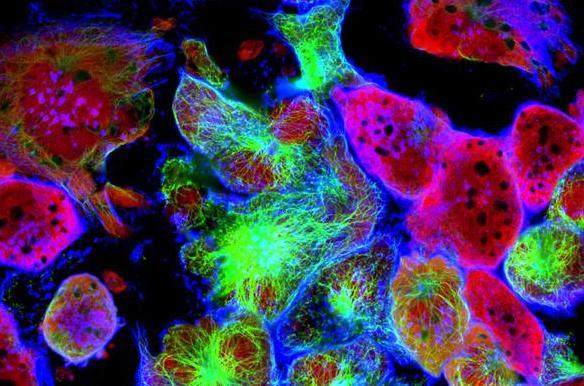 Cancer : il sera bientôt possible de traiter les cellules cancéreuses en analysant leur activité électrique