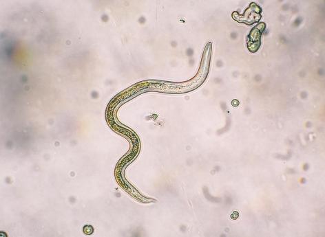 Les parasites intestinaux de l homme. Féreg tünetei, Helminthes intestinaux