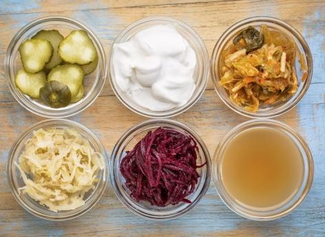 Probiotiques : ces aliments permettent de faire le plein 