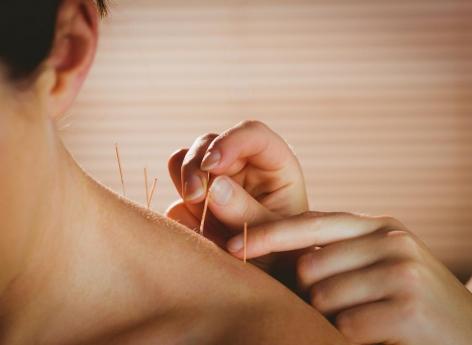 Ménopause : l’acupuncture peut réduire les bouffées de chaleur