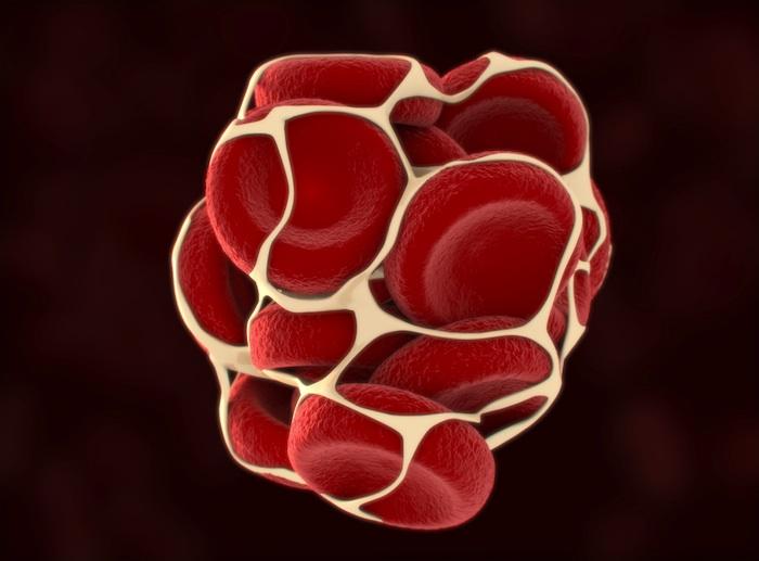 Sa carte vitale n’est pas à jour : le patient meurt d’une embolie pulmonaire