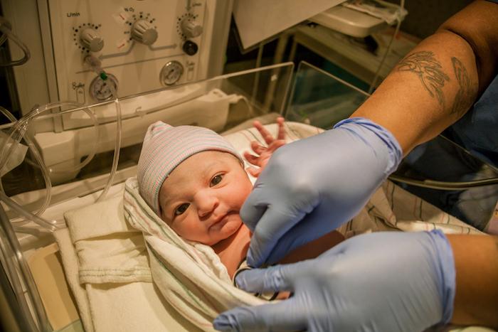 Aux Etats-Unis, des médecins corrigent la malformation d'un foetus de 5 mois