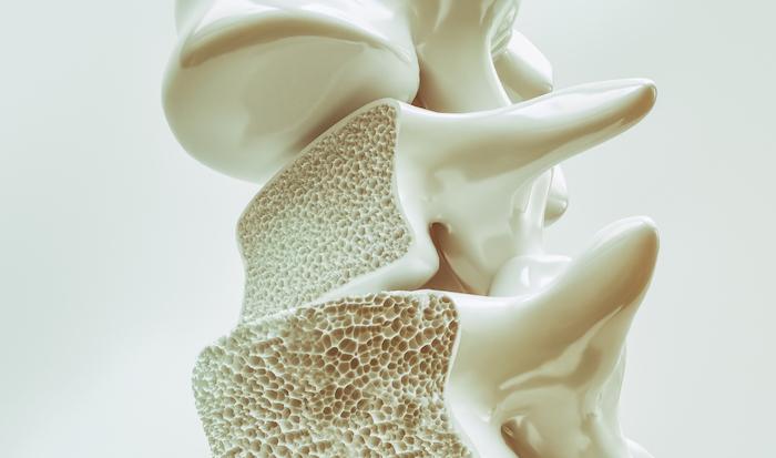 Ostéoporose : une nouvelle stratégie augmente de 800% la masse osseuse