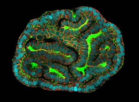 Des mini-organes créés à partir de cellules du liquide amniotique 