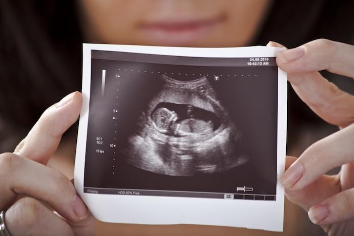 Une femme à deux vagins va devenir maman