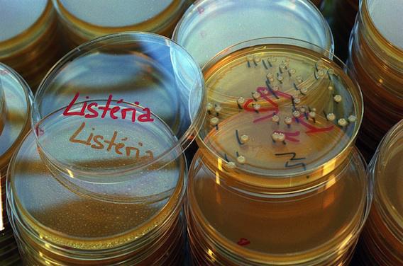 Listéria : l'Institut Pasteur découvre des souches hypervirulentes