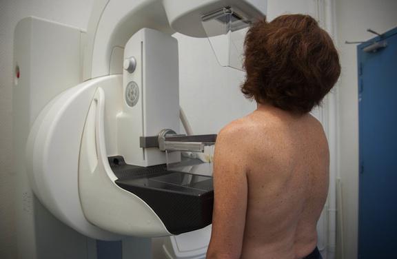 Dépistage du cancer du sein : la mammographie reste l'examen de référence 