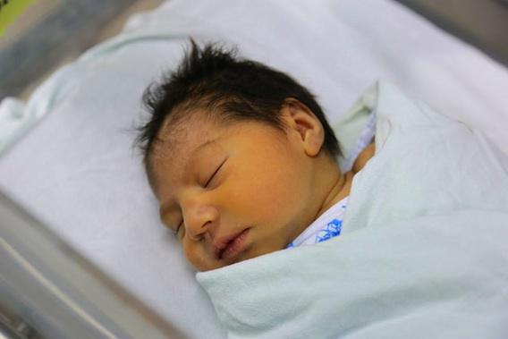 Zika : la microcéphalie pourrait toucher jusqu'à 13 % des bébés