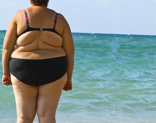 Une personne sur cinq sera obèse en 2025