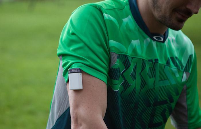 Pancréas artificiel : bilan positif pour les premiers patients à Lyon