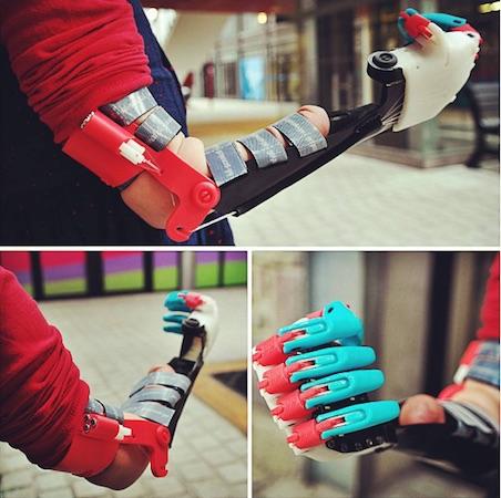 Saint-Brieuc : le fablab offre une prothèse 3D à une petite fille