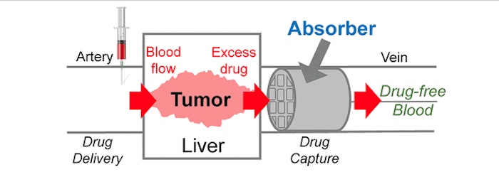 Cancer et chimiothérapie : une éponge en 3D pour absorber le surplus de médicaments